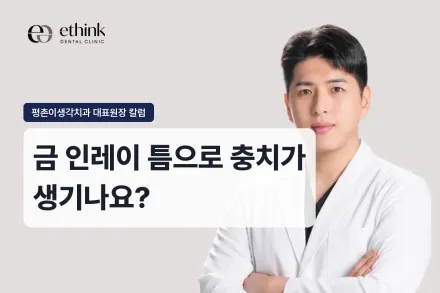 금 인레이 틈으로 충치가 생기나요?