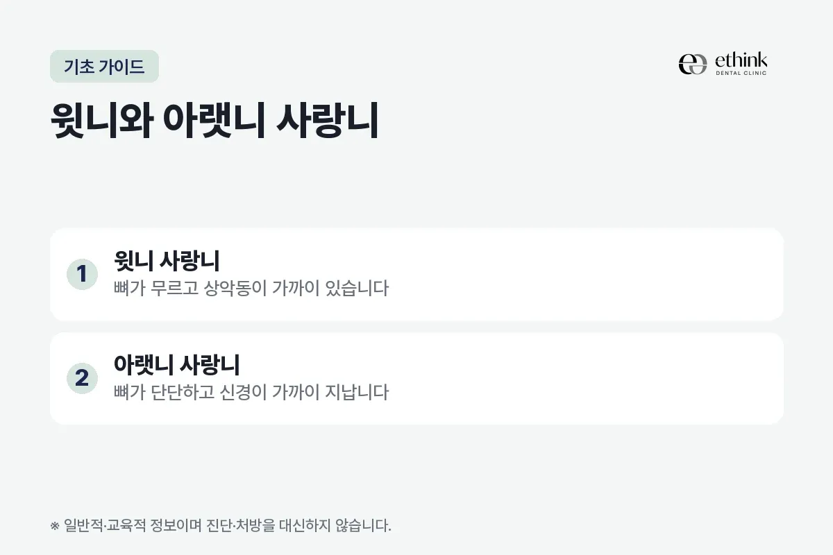 윗니 사랑니는 상악동이, 아랫니 사랑니는 신경이 가깝다는 차이를 정리한 카드