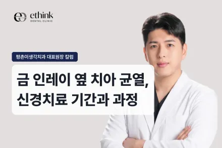 금 인레이 옆 치아 균열, 신경치료 기간과 과정
